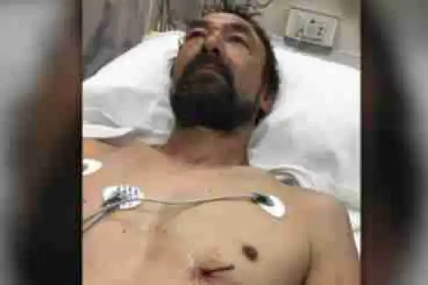 Man Accidentally Shoots Himself In The Heart With 3inch Nail And This Happened (Photos)